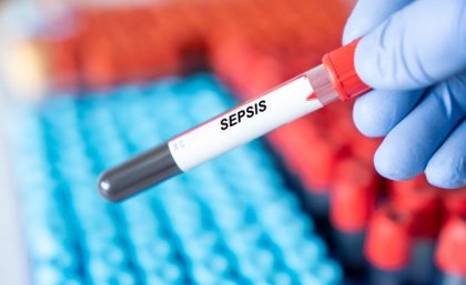 A gloved hand holds a pipette containing blood, with a label that reads Sepsis.